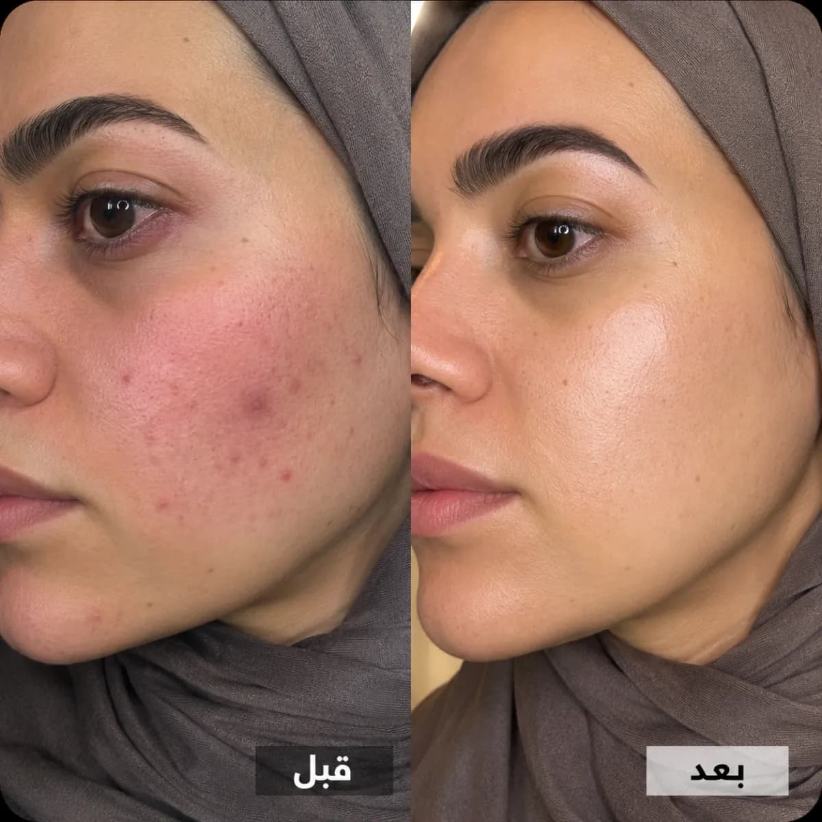 عناية مثالية بثنائي قويّ