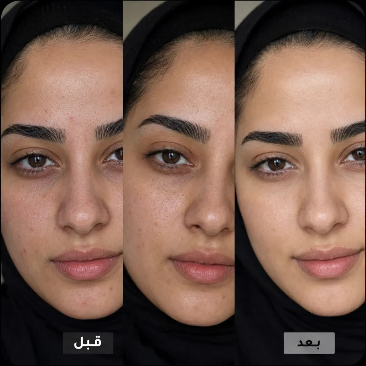وداعاً للانتفاخ