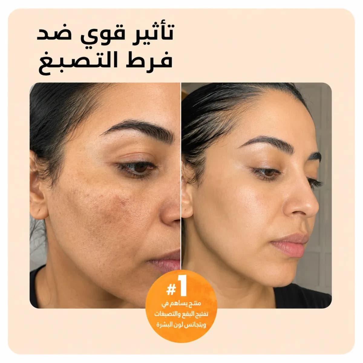 بار التنظيف — Kojiso™