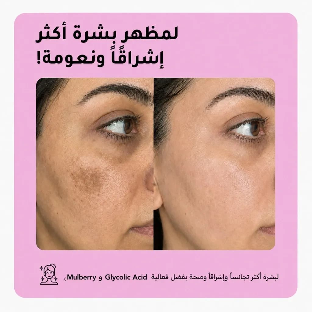 بار التنظيف — Light Up™