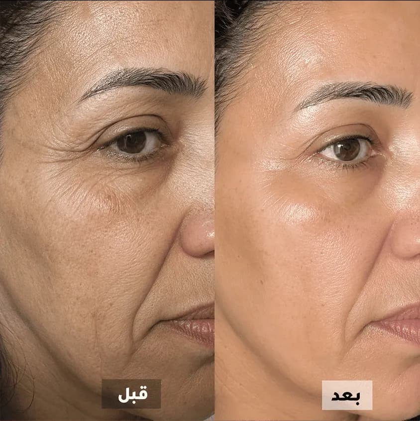 بشرة ناعمة كالزجاج