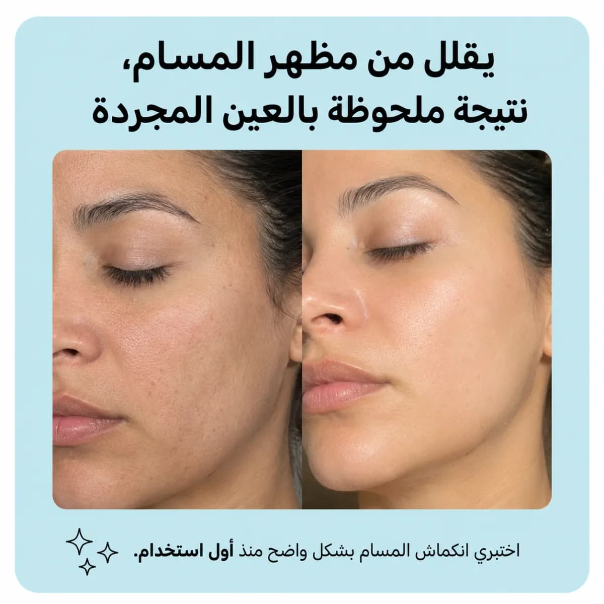 بار التنظيف — Zero Pore™