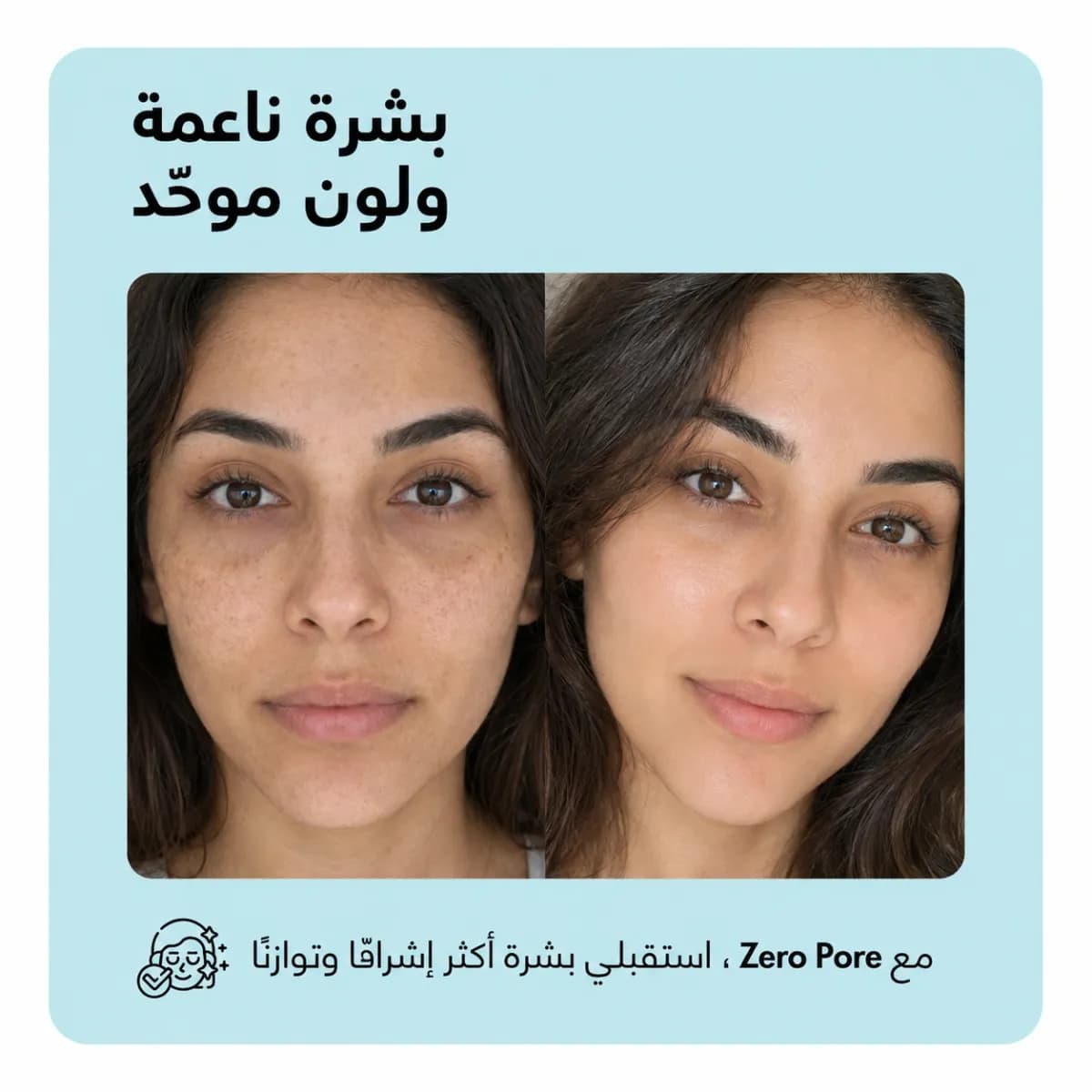 بار التنظيف — Zero Pore™