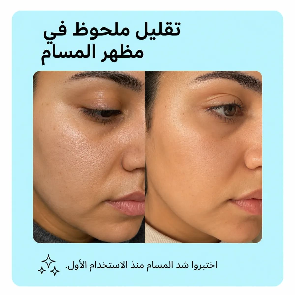 سيروم تصغير المسام — Zero Pore™